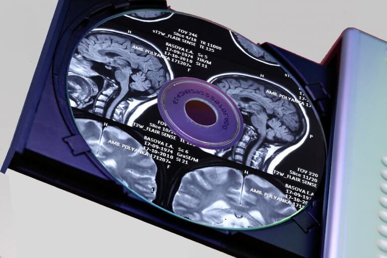 ACETIAM - MARS imagerie médicale CD/DVD